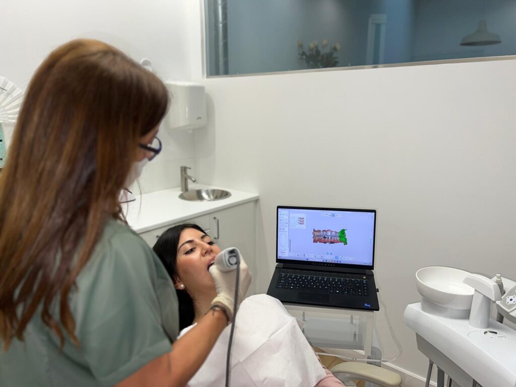 Escaner intraoral Escaner intraoral
